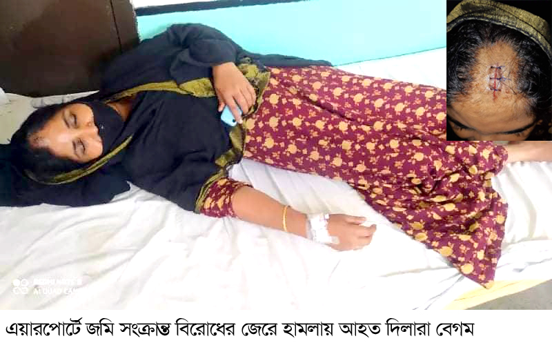 এয়ারপোর্টে জমি সংক্রান্ত বিরোধের জেরে হামলা: আহত ১