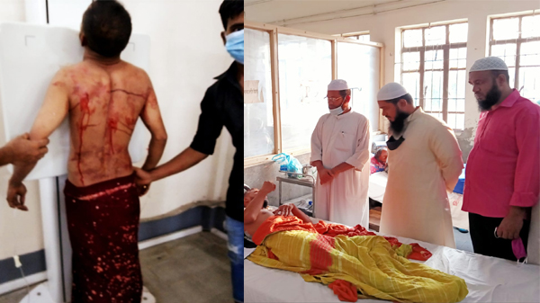 ইসলামী আন্দোলনের নেতার উপর সন্ত্রাসী হামলা: সন্ত্রাসীদের গ্রেপ্তার দাবি