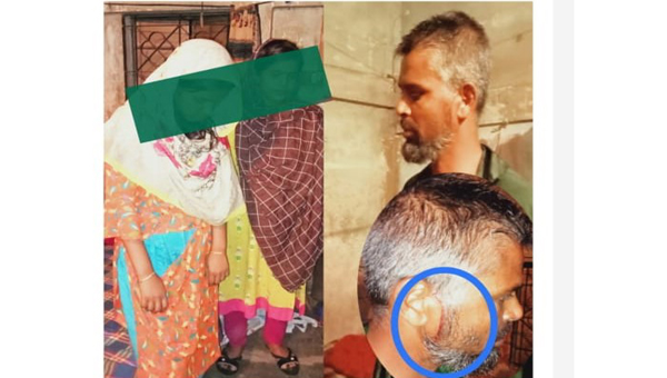 বাদামবাগিচায় তরুণীকে ধর্ষণচেষ্টা, হামলা: অভিযোগ দায়ের