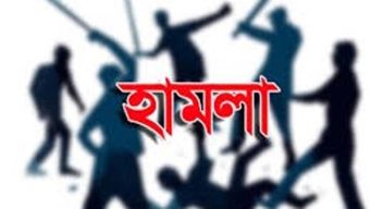 সিলেটে আইনজীবীর উপরে হামলা