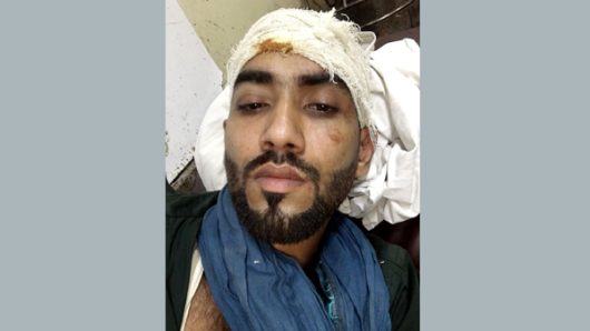 শরীফগঞ্জে বিএনপি নেতার গাড়িতে আওয়ামী লীগ নেতার অগ্নিসংযোগের চেষ্টা: সংঘর্ষে আহত ১