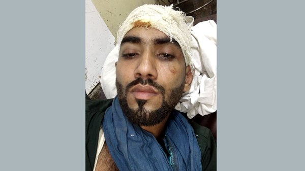 শরীফগঞ্জে বিএনপি নেতার গাড়িতে আওয়ামী লীগ নেতার অগ্নিসংযোগের চেষ্টা: সংঘর্ষে আহত ১