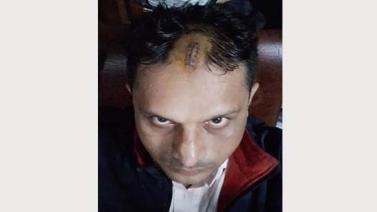 সন্ত্রাসীদের হামলায় বিএনপি নেতা আবু শফি মোহাম্মদ আশরাফ বাদল গুরুতর আহত, ওসমানী হাসপাতালে প্রেরণ