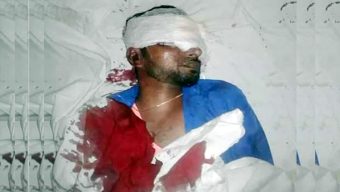 ছাতকের জায়গা জমির জের গুলিবিদ্ধ হয়ে যুবক খুন