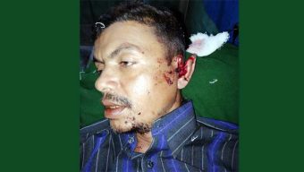পূর্বের শত্রুতার জেরে ছাত্রলীগ নেতার বাড়িতে হামলা ও তার চাচা গুরুতর আহত