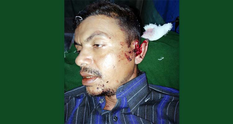 পূর্বের শত্রুতার জেরে ছাত্রলীগ নেতার বাড়িতে হামলা ও তার চাচা গুরুতর আহত