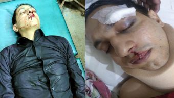 আম্বরখানায় সন্ত্রাসী সুমনের হামলায় মো: আবুল খায়ের আল রশিদ আহত