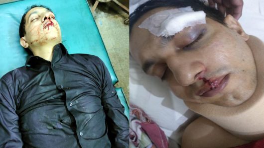 আম্বরখানায় সন্ত্রাসী সুমনের হামলায় মো: আবুল খায়ের আল রশিদ আহত