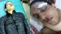 আম্বরখানায় সন্ত্রাসী সুমনের হামলায় মো: আবুল খায়ের আল রশিদ আহত