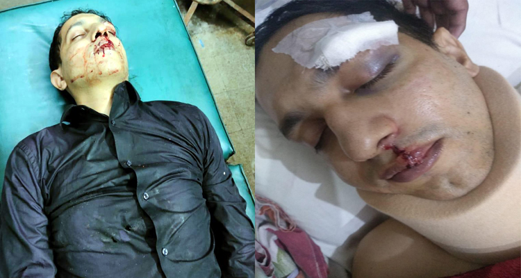 আম্বরখানায় সন্ত্রাসী সুমনের হামলায় মো: আবুল খায়ের আল রশিদ আহত