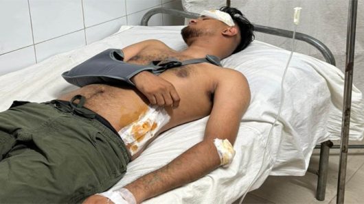 কানাডা প্রবাসী রাজীব পালের উপর দুর্বৃত্তের হামলা
