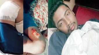 পূর্ব বিরোধের জেরে দুর্বৃত্তের হামলায় মো: আবুল মনসুর আহত