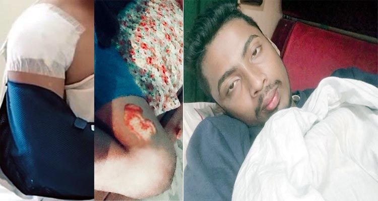 পূর্ব বিরোধের জেরে দুর্বৃত্তের হামলায় মো: আবুল মনসুর আহত